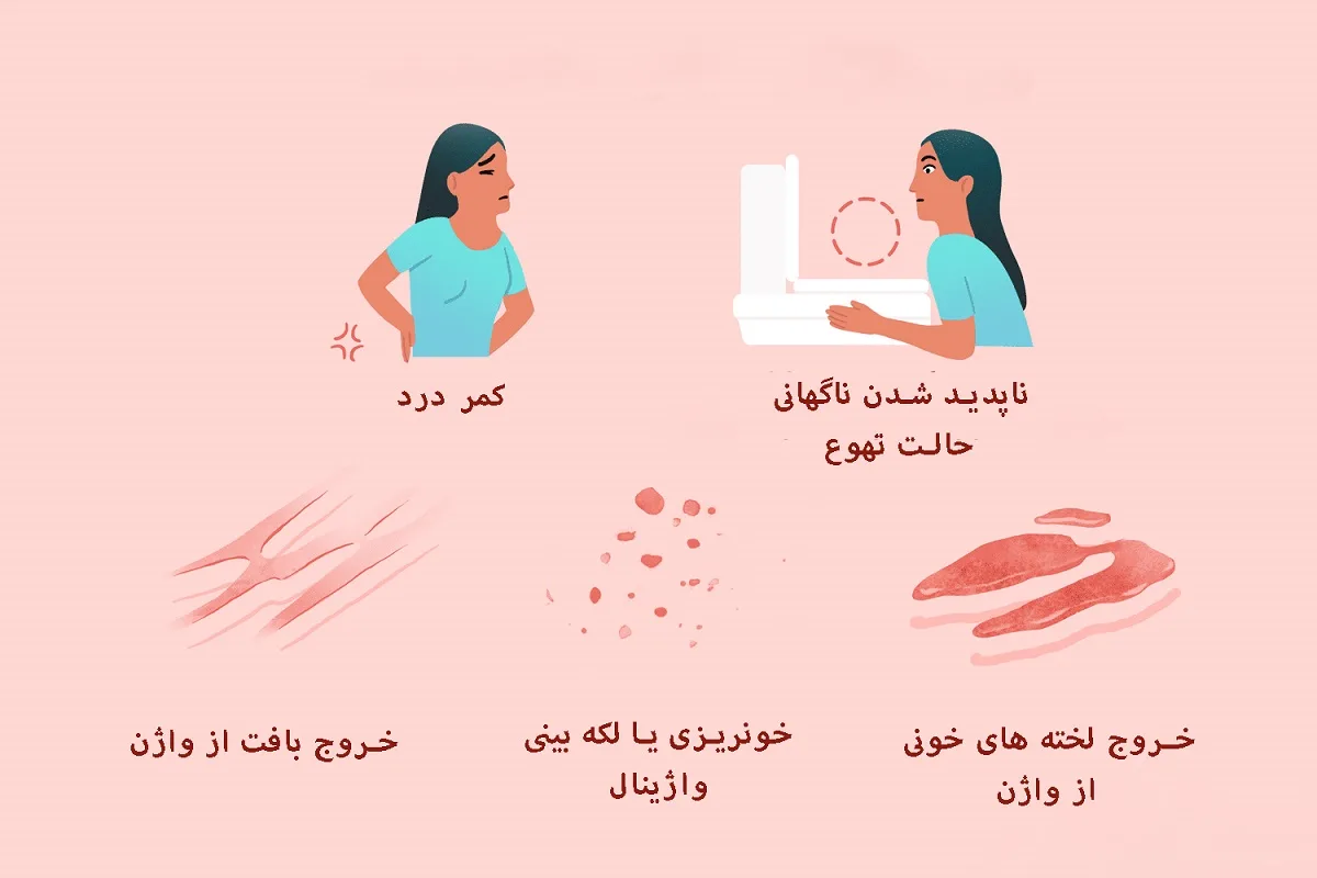 نشانهها و علائم سقط جنین