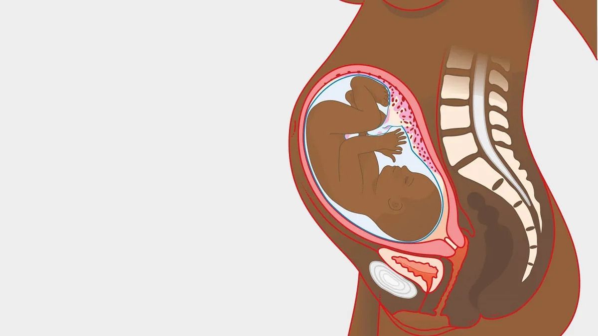 وضعیت مادر در هفته سی و چهارم بارداری